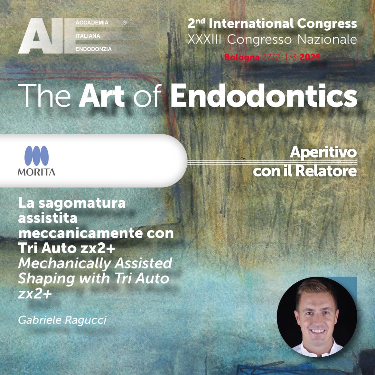 La sagomatura assistita meccanicamente con Tri Auto zx2+ - Mechanically Assisted Shaping with Tri Auto zx2+